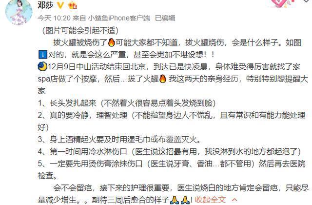 女明星拔罐致深二度烧伤,女星拔火罐被烫伤