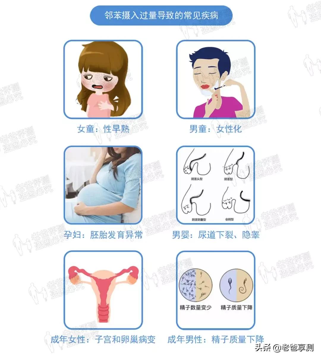 厨房贴纸防油防水耐高温哪种好,厨房的防油贴纸很难撕下来怎么办