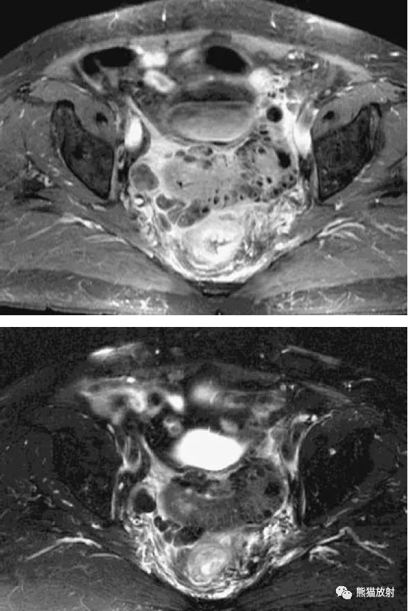 腹部影像图片大全,乙状直肠疼痛位置图片