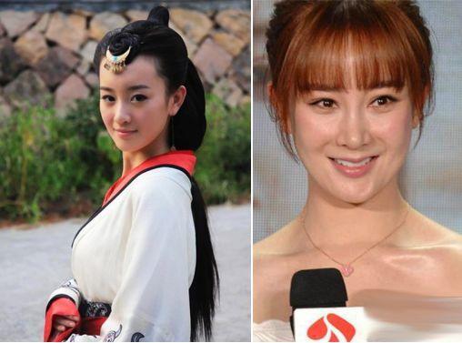 王菲120万童颜针有用吗,王菲童颜针是生长因子吗