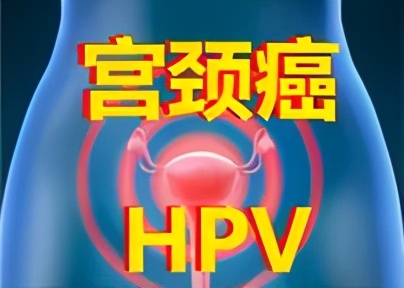 感染hpv为什么要检测基因,感染hpv多久没有出现症状就没事了