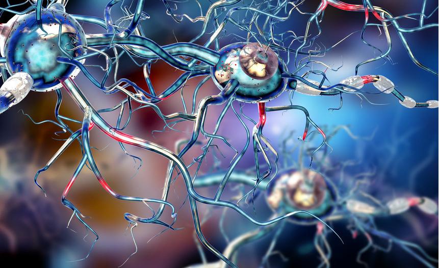 什么叫药物使用过量性头痛,有一种头痛叫药物过度使用性头痛