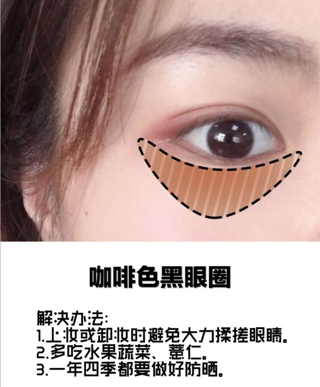 黑眼圈很重怎么办男士,黑眼圈很重怎么办中医教你