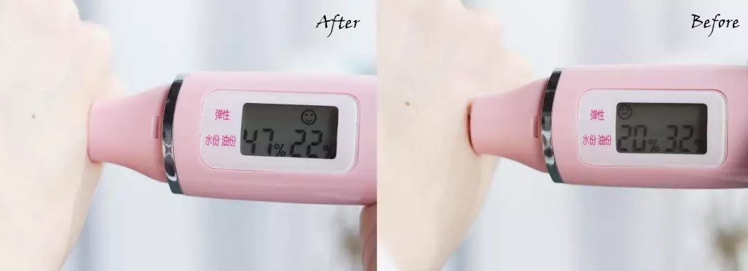 强力鸡皮皂,鸡皮肤救星正品