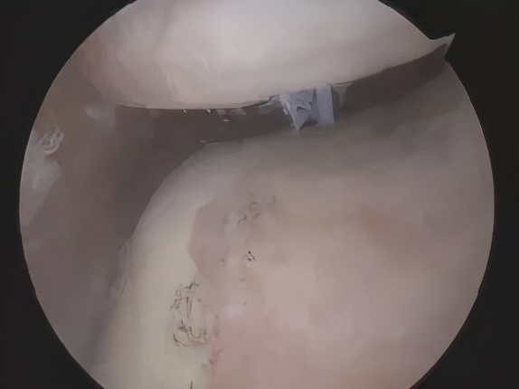 膝盖痛12种疼痛对照表图解,不同部位膝盖疼痛的原因