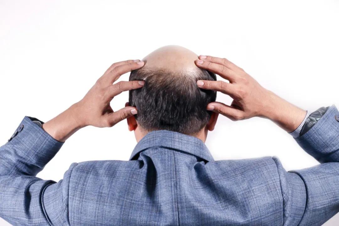 头发一薅就下来怎么办,头发一薅就掉是怎么回事