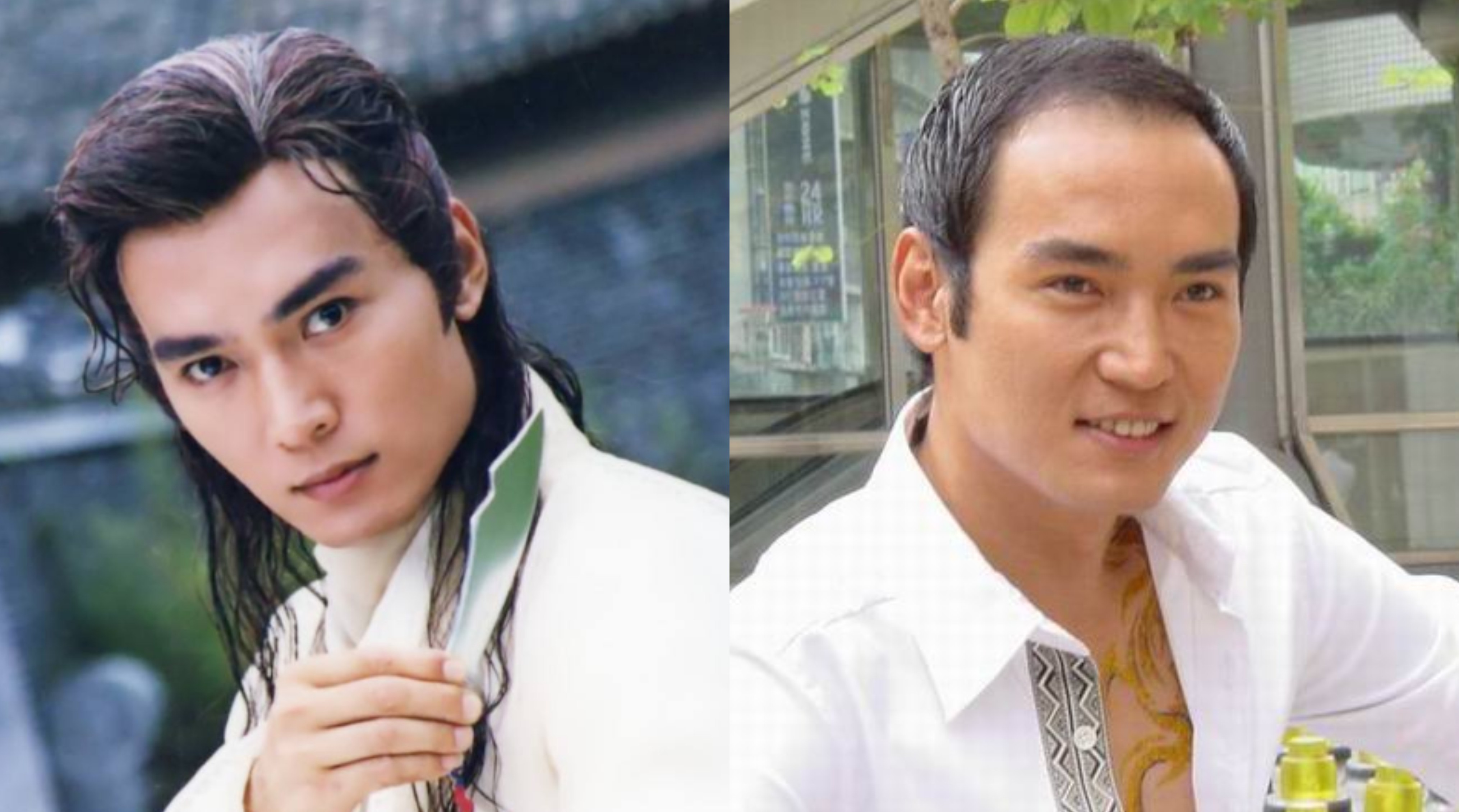 m型脱发也帅的男明星,帅气也挡不住脱发的10位男明星