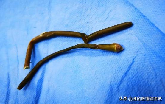 少年血尿是什么原因引起的,少年血尿是怎么回事