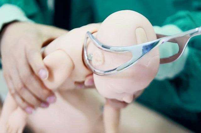 产钳夹伤宝宝医生有责任吗,婴儿产钳夹伤40天还没消正常吗