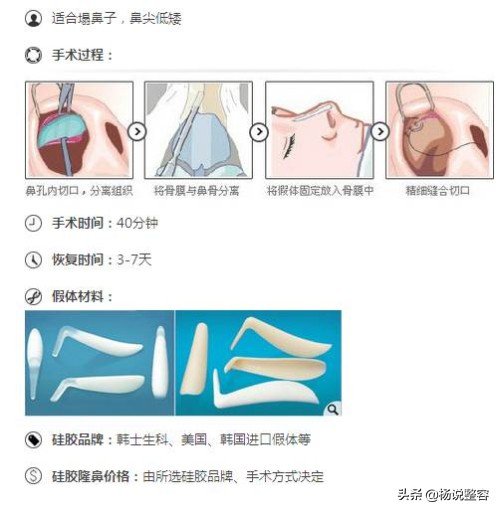隆鼻失败修复的几点建议,隆鼻失败医生会马上为患者修复吗