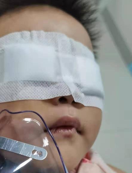 一岁多宝宝霰粒肿康复过程全纪录