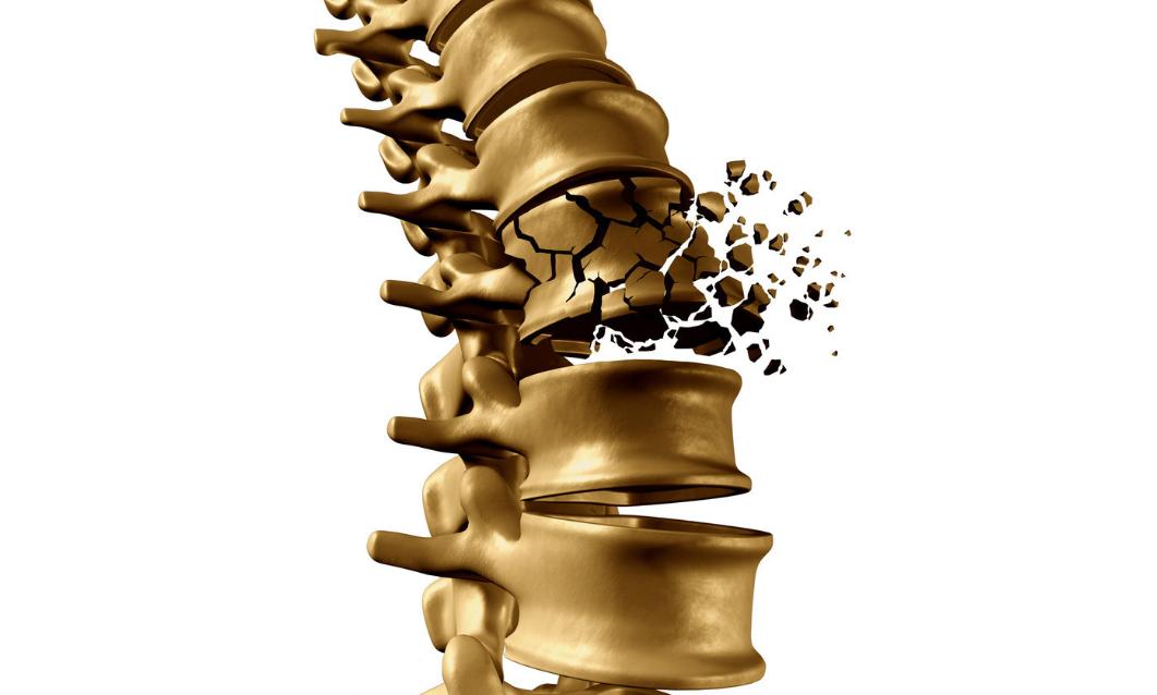 特立帕肽目前多少钱一针,特立帕肽促进骨愈合吗