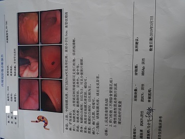 长期咽喉不适要警惕四种病,咽喉不舒服会引起哪些疾病