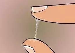 白带异常是怎么回事？今天一次性说清楚