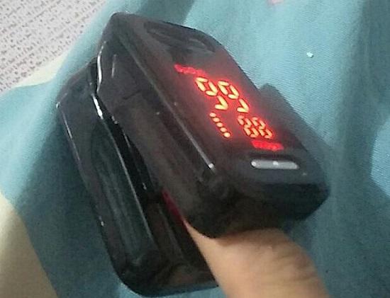 甲减是怎么回事能吃海带吗,甲减是怎么回事好治疗吗用什么药