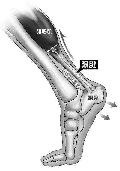 跑步大腿疼和小腿疼有什么区别,跑步之后脚跟疼怎么回事