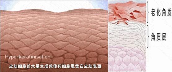 皮肤怎么变得白白嫩嫩干干净净,怎么让自己变得白白嫩嫩