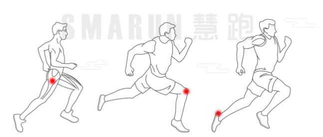 跑者小腿内侧痛,大神级跑者小腿