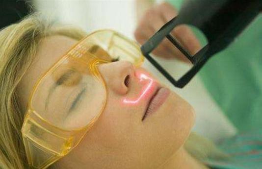 激光祛痘真的能去彻底么,点阵激光祛痘坑痘疤有副作用吗