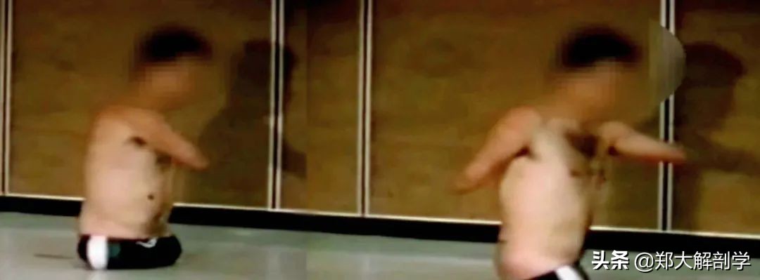 下背部疼痛吃什么药,治疗背部疼痛的最好方法