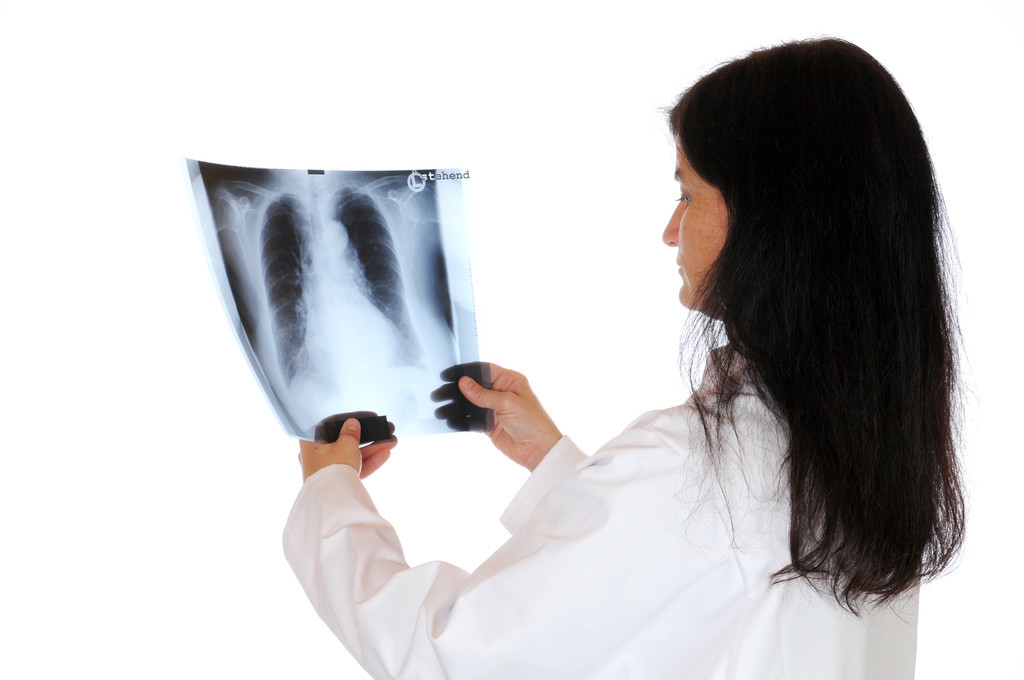 腰椎间盘膨出最佳消除方法是什么,腰椎间盘膨出是怎么引起