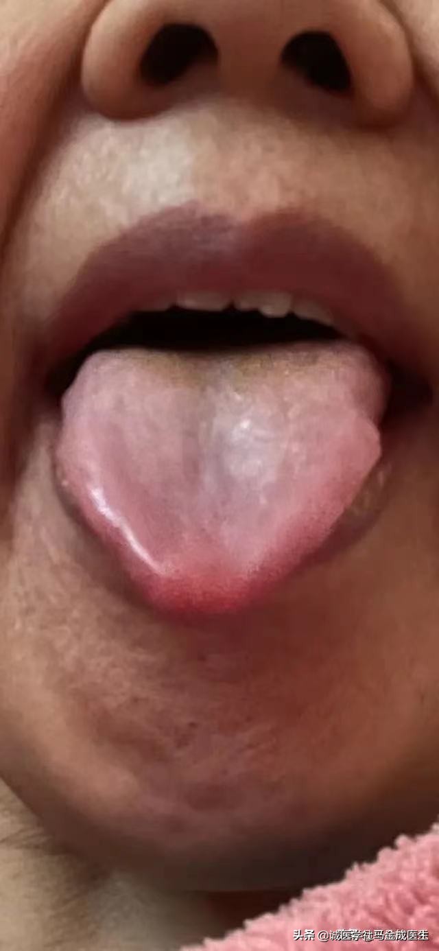 更年期月经量少吃什么中成药,痛经吃哪种中成药见效快