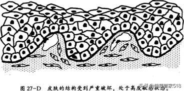 为啥会过敏什么原因导致的,酒精过敏怎样改善过敏体质