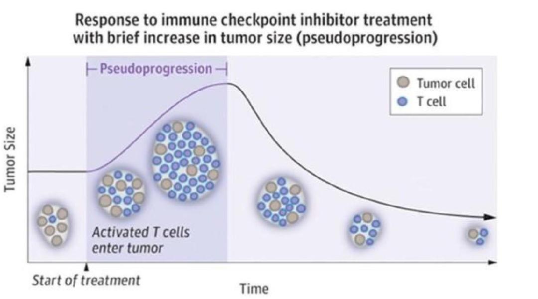 pd-1免疫治疗治愈案例,pd-1免疫治疗有效率是指什么