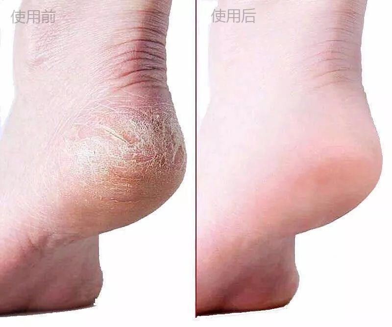 王鸥露背照片,王鸥最新露背写真