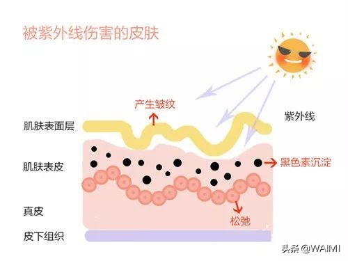 晒后皮肤发红怎么修复,敏感肌肤晒后长斑怎么修复