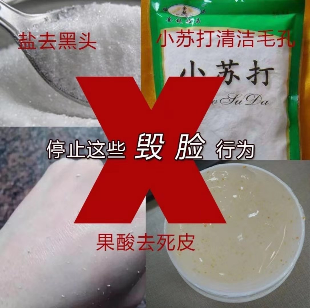 小苏打加醋洗头能去除黑头吗,小苏打洗脸可以去黑头吗