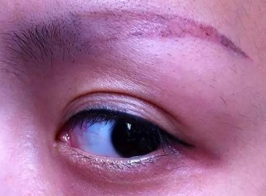 为什么不建议女人纹眉纹美瞳线,女生为什么不建议纹眉毛