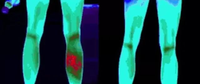 拿在手上可以旋转的按摩器,拿在手上按摩手的穴位的小玩具