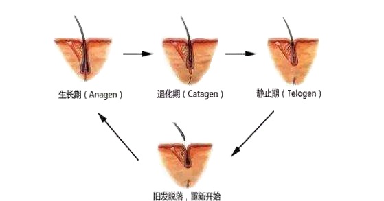 脂溢性脱发忌口食物一览表,脂溢性脱发应该吃什么食物