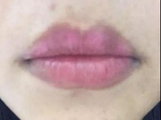 纹绣师怎么处理纹唇后肿,纹绣师漂唇过程发朋友圈