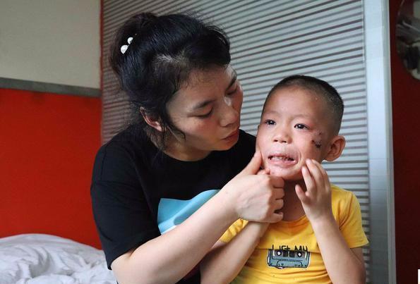 孩子上火了怎么预防感冒,小孩儿上火了该用什么方法治疗