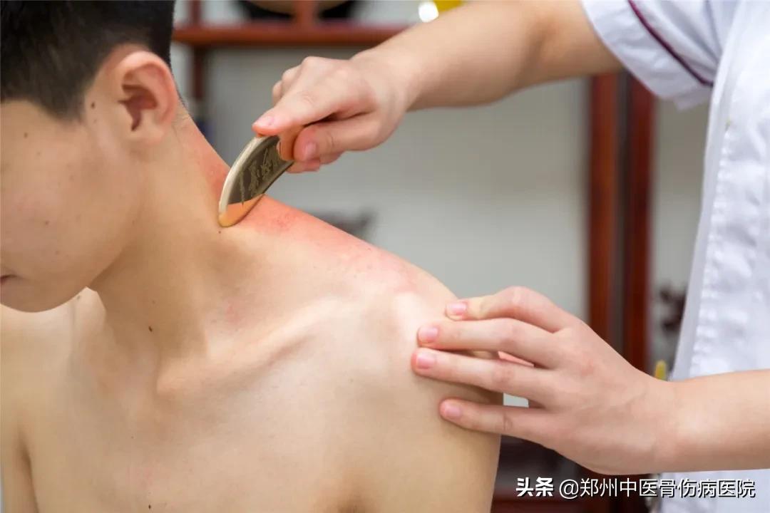 郑州骨伤病医院怎么样,中医骨伤郑州