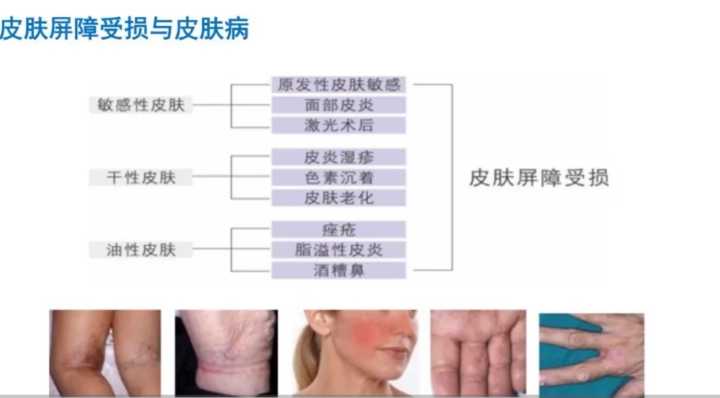 粉底液发黄暗沉怎么办,哪种粉底液不容易脱妆暗沉