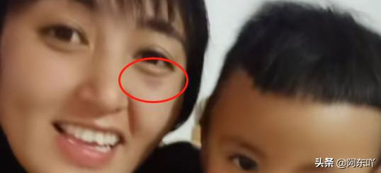 为爱远嫁的女孩被婆婆打,为爱远嫁新疆却遇家暴