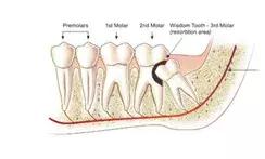 98%的人嘴里都有一颗“定时*弹炸**”，看看你中招了吗？