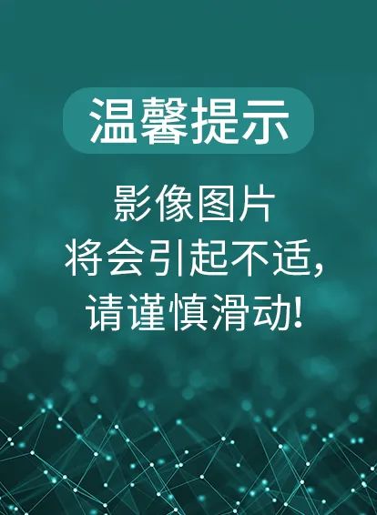 颈部肿块为什么有80%是肿瘤,颈部肿块1年没有变化