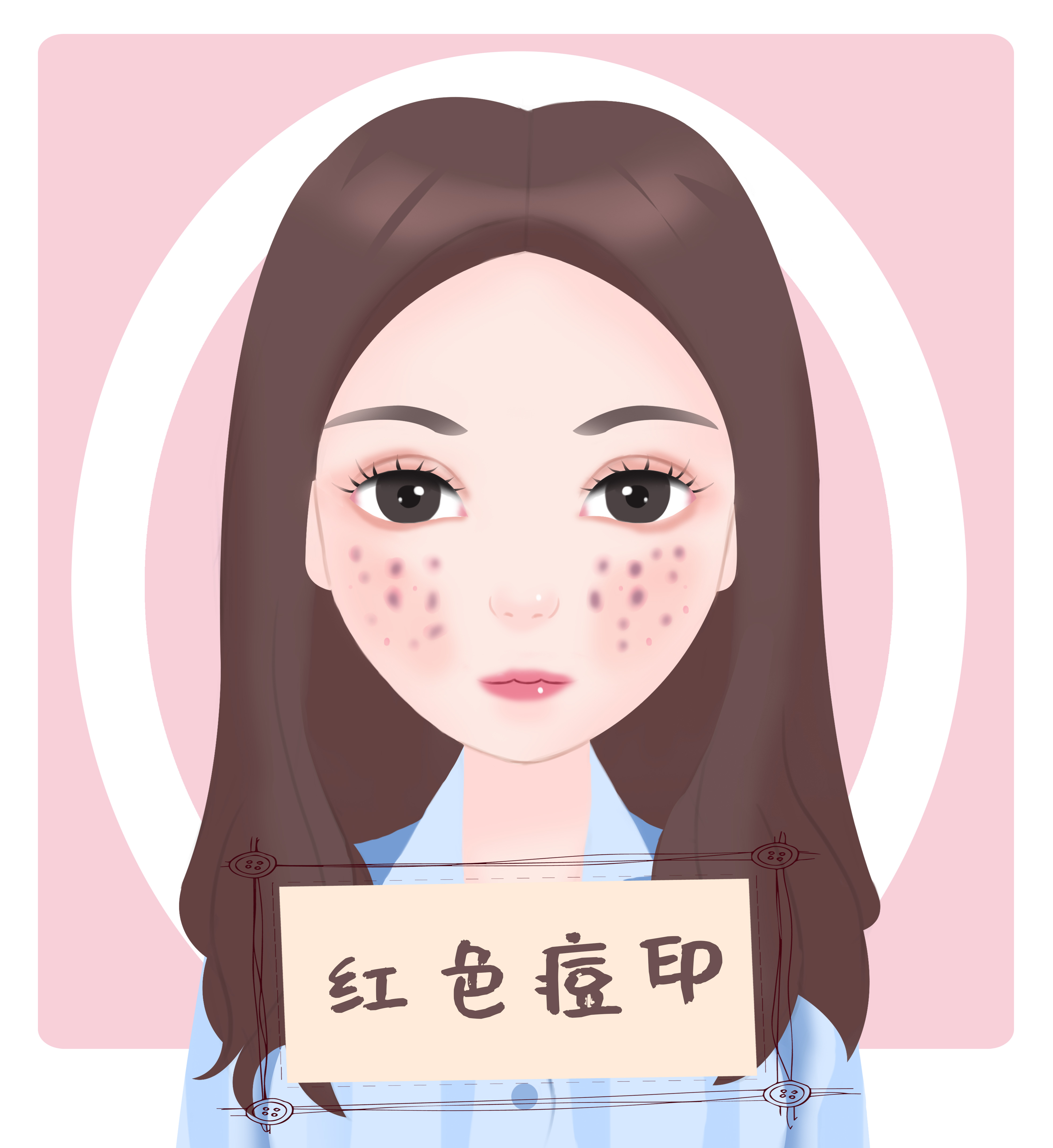 如何快速消除痘印医美,产后痘印怎么快速消除