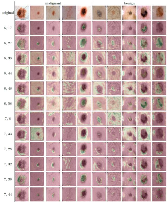 浅谈医学影像技术,医学图像分析深度学习模型