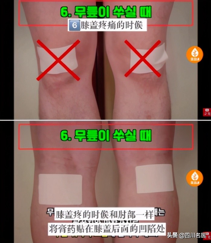 哪儿疼贴哪儿,膏药是不是哪儿疼贴哪儿