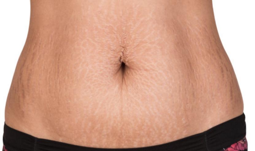 受伤的伤疤愈合后为什么还痛,好了伤疤忘了疼为什么