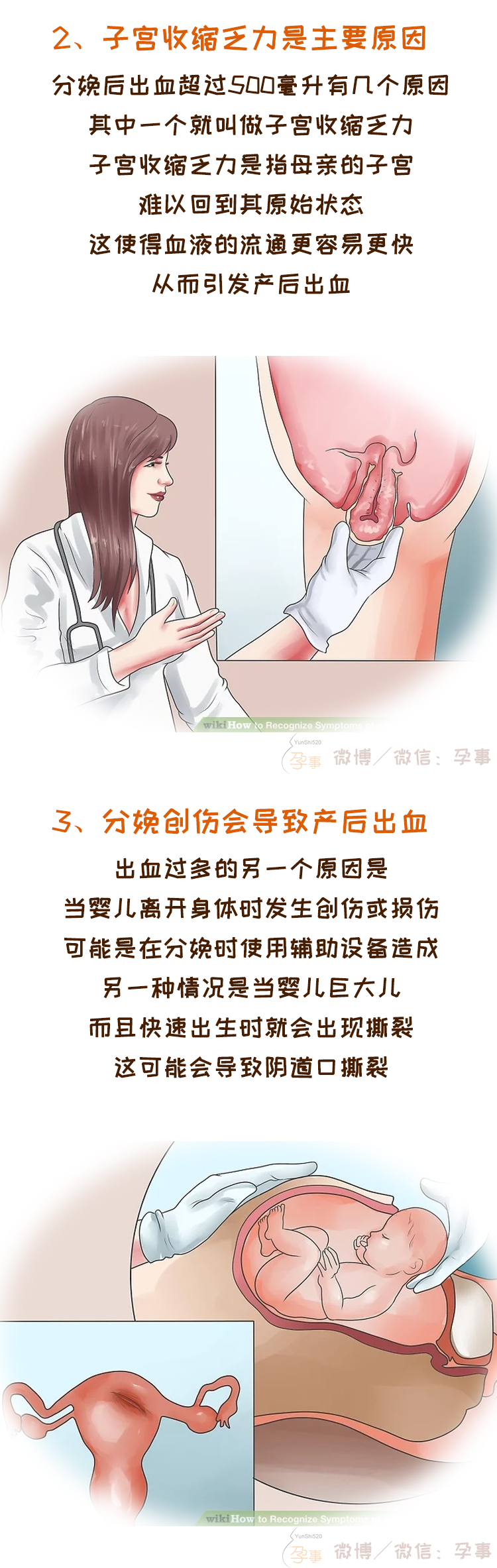 产后6个月子宫老是异常出血,产后55天子宫异常出血