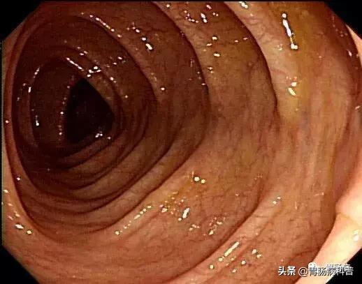 肠镜检查，肛肠检查。。。会不会很尴尬啊