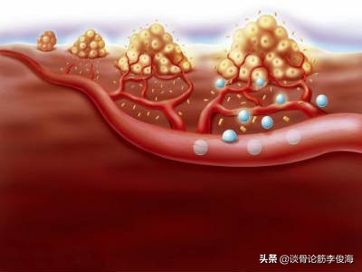 膝盖痛用手掌拍打有什么好处,拍打膝盖的十大好处
