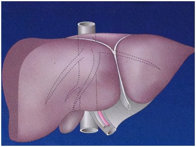为什么肝血管瘤医生建议不用管,有了肝血管瘤要注意什么