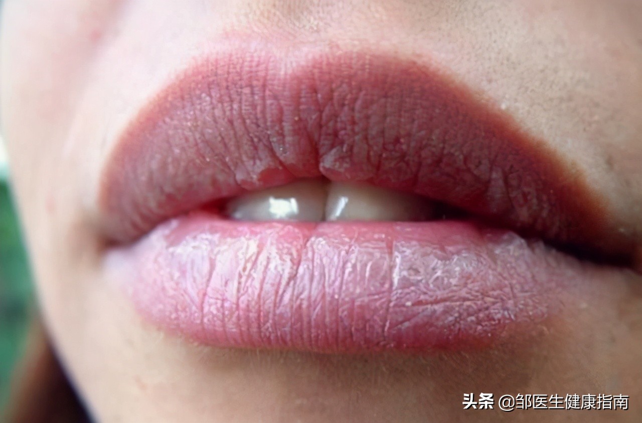 脸上有血丝是肝脏出了问题了吗,脸反映的是什么器官